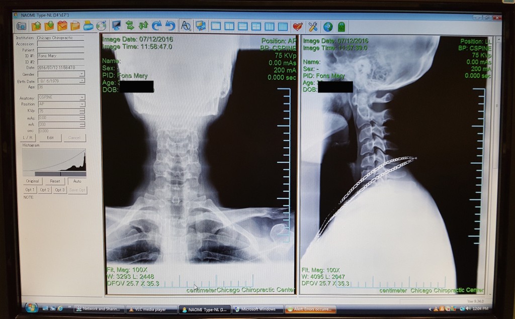 Just look at dem bones! X-ray, chiropractor; photo of x-ray, me.  